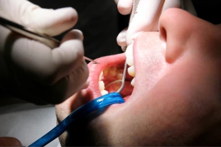 Dental Cleanings & Check-ups
