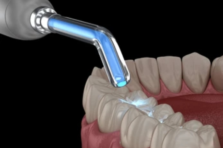 Dental Restoration