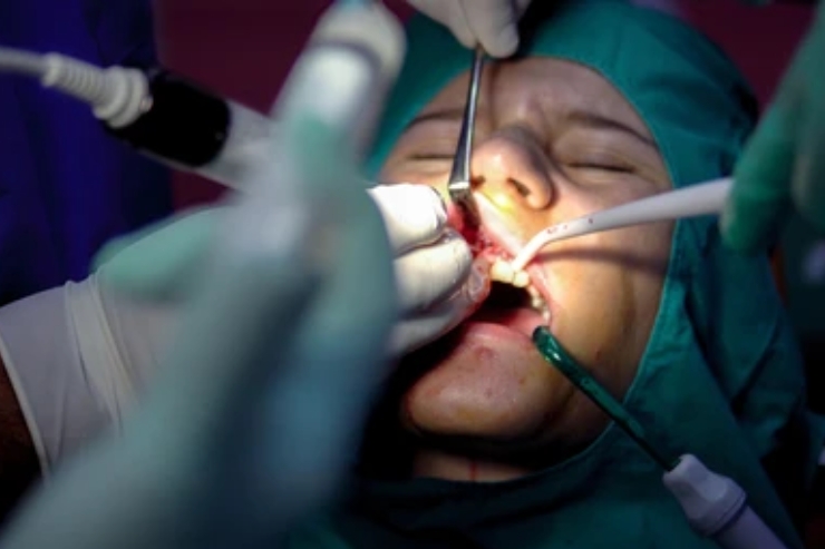 Oral Surgery